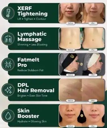 Daftar treatment Embba seperti XERF tightening, lymphatic massage, fatmelt pro, DPL hair removal, dan skin booster